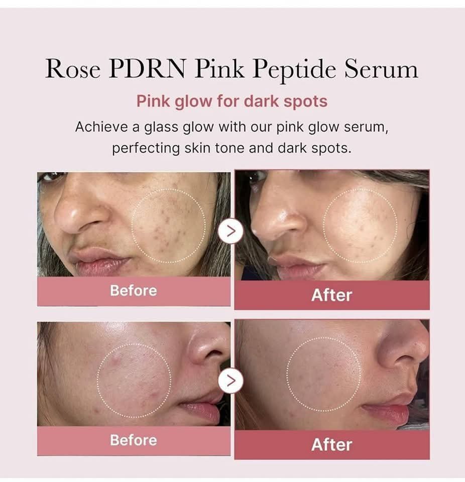 Medicube PDRN Pink Peptide Serum 30ml