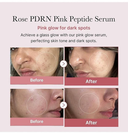 Medicube PDRN Pink Peptide Serum 30ml