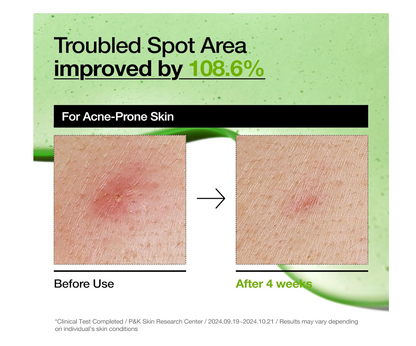 ANUA Azelaic Acid 10 Hyaluron Redness Soothing Serum