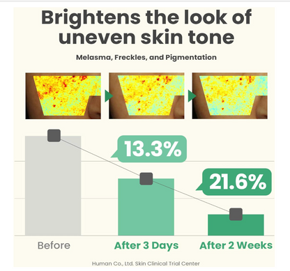 AXIS-Y Dark Spot Correcting Glow Serum 50ml